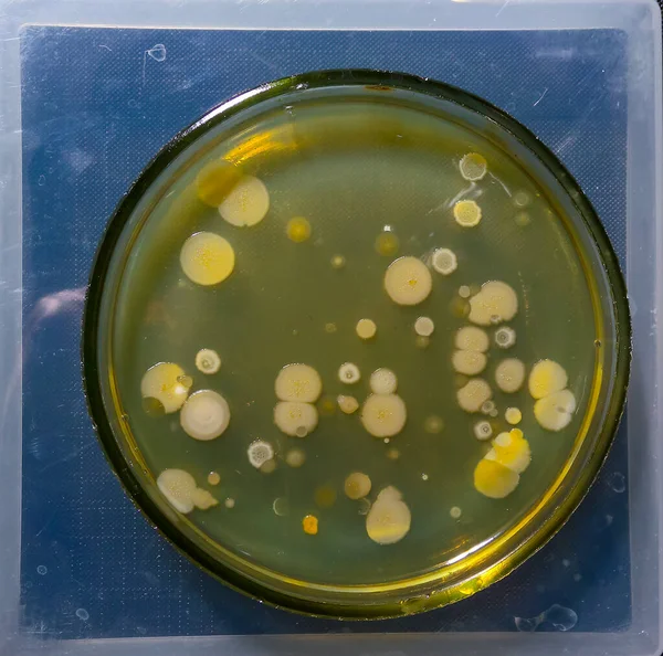 Kolonie Bakterii Chorobotwórczych Płytce Petriego Badania Mikrobiologiczne — Zdjęcie stockowe
