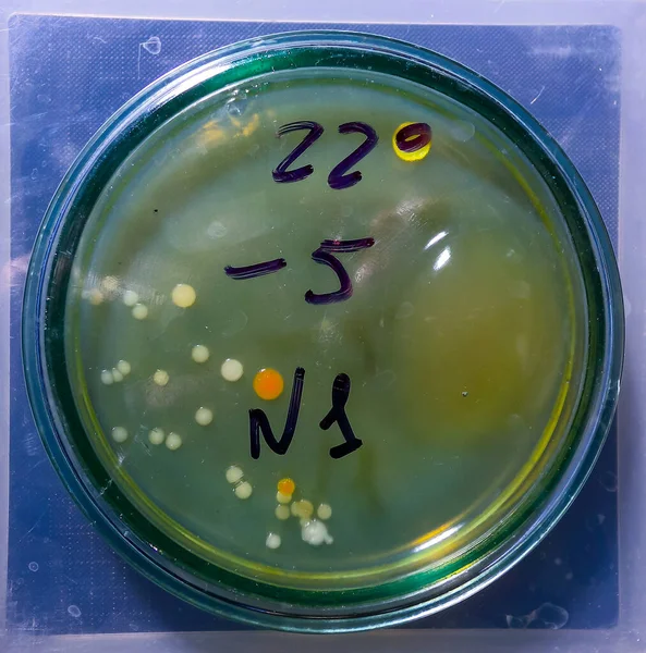 Kolonie Bakterii Chorobotwórczych Płytce Petriego Badania Mikrobiologiczne — Zdjęcie stockowe