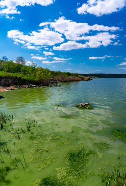 Khadzhibey haliçlerinin ötrofikasyonu, mavi-yeşil alglerin sularında çiçek açması mikrostis aeruginosa ve yeşil alg Enteromorpha sp 'un kitlesel gelişimi..