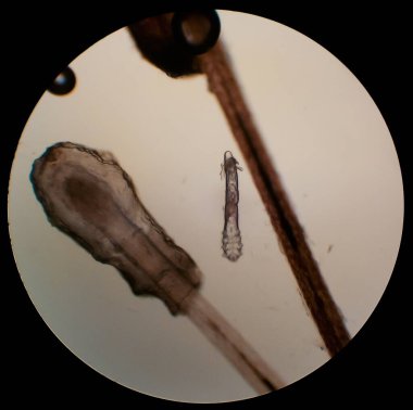 Demodex folliculorum - bir insan gözünün kirpiklerinde parazit miti, mikroskop