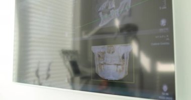 Diş muayenehanesindeki ekrandaki çene röntgenleri