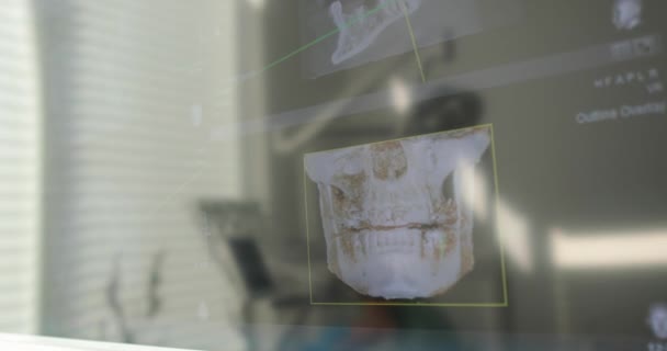 歯科オフィスのスクリーン上の顎のX線 — ストック動画
