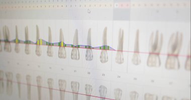 Ağız sağlığı kliniğindeki bilgisayar monitörleri.