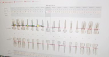 Ağız sağlığı kliniğindeki bilgisayar monitörleri.