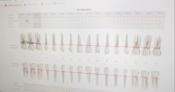 Computer Monitors Oral Care Clinic — Stock Video