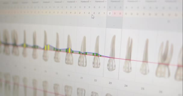 Computer Monitors Oral Care Clinic — Stock Video