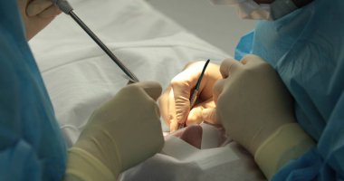 Diş tedavisi, yakın plan. Bir dişçi bir diş prosedürü uygular. Dişçinin elleri iş başında. Diş hekiminde tedavi sürecinde ağız boşluğu.