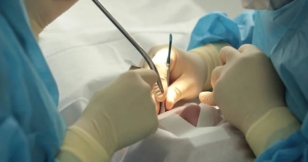 Tandheelkundige Behandeling Close Een Tandarts Voert Een Tandheelkundige Ingreep Tandartsenhanden — Stockfoto