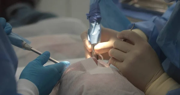 Лікування Зубів Крупним Планом Стоматолог Проводить Стоматологічну Процедуру Руки Стоматолога — стокове фото