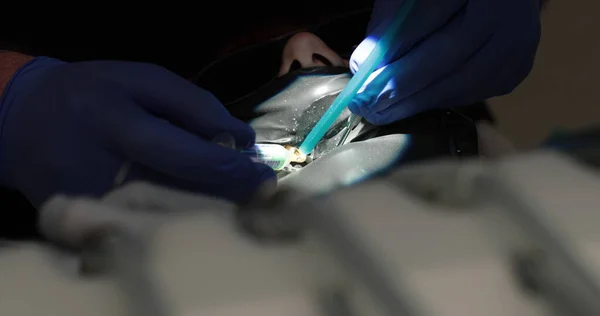 Стоматологическое Лечение Крупным Планом Стоматолог Проводит Стоматологическую Процедуру Руки Дантиста — стоковое фото