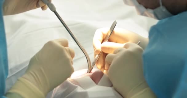 牙科治疗特写 牙医做牙科手术 牙医的手在工作 牙科医生治疗过程中的口腔 — 图库视频影像