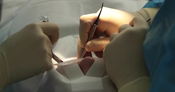 Zubní Ošetření Zblízka Zubař Provádí Stomatologický Zákrok Zubařovy Ruce Práci — Stock video
