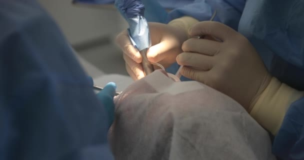 Tratamento Dentário Close Dentista Realiza Procedimento Odontológico Mãos Dentista Trabalho — Vídeo de Stock
