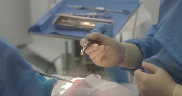 牙科治疗特写 牙医做牙科手术 牙医的手在工作 牙科医生治疗过程中的口腔 — 图库视频影像