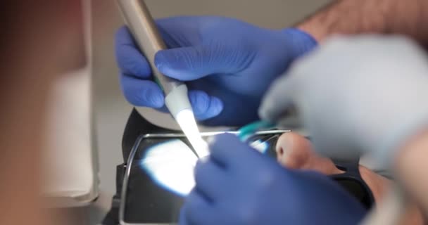 Primo Piano Del Trattamento Dentale Dentista Esegue Una Procedura Dentale — Video Stock