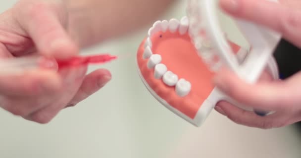 Dłonie Dentysty Pokazują Sztucznej Szczęce Zasadę Mycia Zębów Proces Leczenia — Wideo stockowe