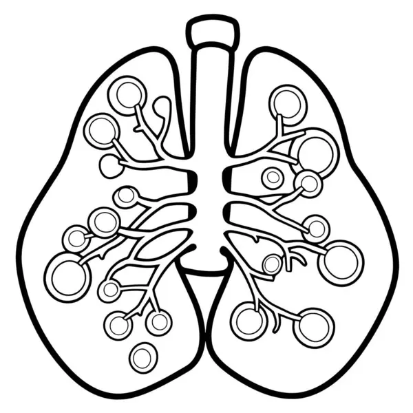 Esquema Limpio Ilustración Pulmón Tuberculoso Ideal Para Educación Sanitaria — Archivo Imágenes Vectoriales