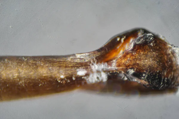 Микроскопический Мир Корень Волос Человека — стоковое фото
