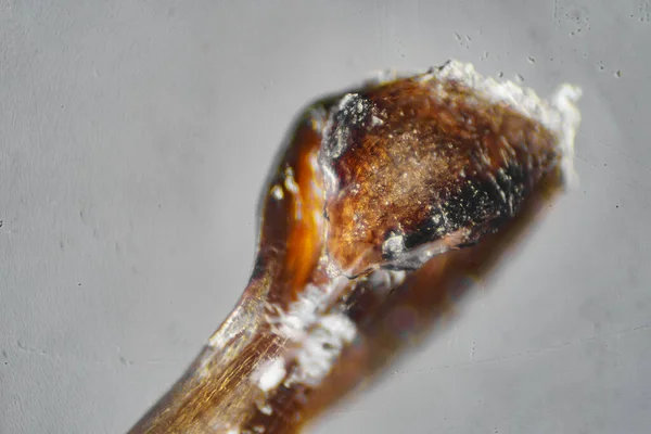 Microscopic World Human Hair Root — Stock Photo, Image
