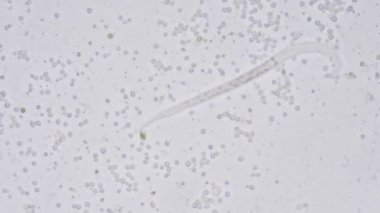 Mikroskobik Dünya. Nematode veya yuvarlak solucan.