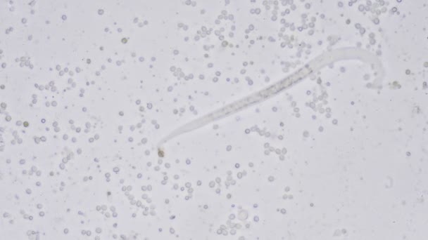 Microscopic World Nematode Roundworm — Stock Video