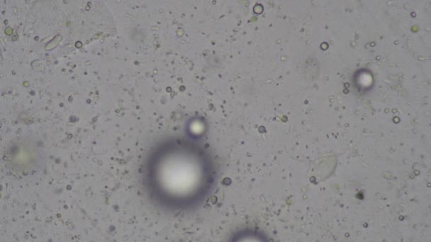 顕微鏡の世界 水中の微生物 — ストック動画