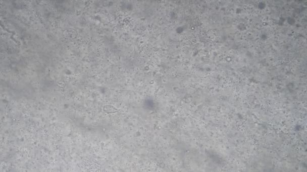 Μικροσκοπικό Κόσμο Σπέρμα Κάτω Από Μικροσκόπιο — Αρχείο Βίντεο