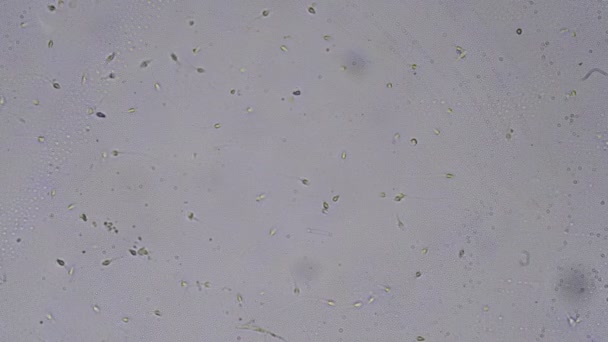 Микроскопический Мир Сперма Микроскопом — стоковое видео