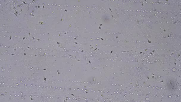 Mikroskobik Dünya Sperm Mikroskop Altında — Stok video