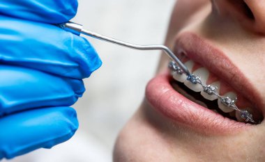 Diş aygıtı ile diş tellerini kontrol eden ortodontiste yakınlaş.