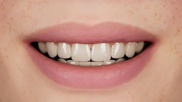 Usmívající Samičí Ústa Ideálními Bílými Zuby Detailní Záběr Usmívající Ženy — Stock fotografie