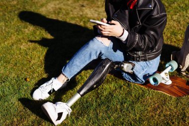 Protez bacaklı bir bayan öğrencinin üniversite kampüsünde yeşil çimlerde oturup akıllı telefon kullanmasına yakın çekim. Parkta biyonik bacağı olan engelli insanlar. Telefon kullanan protez ekipmanlı bir kadın..