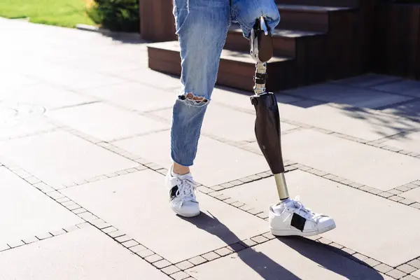 Portrait of young woman with prosthetic leg staying in city. Woman with prosthetic leg. Woman with leg prosthesis equipment.