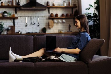 Bacak protezi olan kadın meslektaşıyla dizüstü bilgisayarla iletişim kuruyor. Engelli pozitif kadın video çağrıları yoluyla etkili iletişim kurmak için aygıt kullanıyor