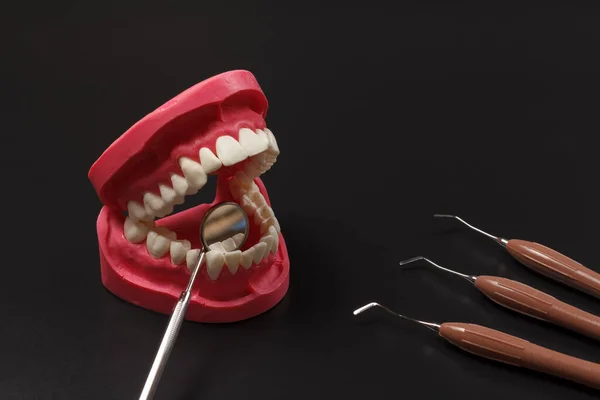 Layout Human Jaw Mouth Mirror Dental Restoration Instruments Black Background — Stock Photo, Image