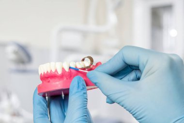 Diş hekiminin elinin insan çene yapısı ve interdental kürdan fırçasıyla yakın görüntüsü. Arka planda diş muayenehanesi.