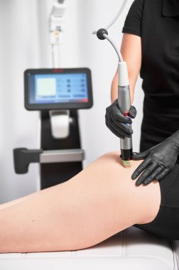 Kozmetik uzmanının mikronlama cihazını kullanarak kadın kalçasında radyasyon tedavisi uygularken kapatın. Güzellik salonunda cilt gerdirme izleri çıkarma prosedürü olan bir kadın..