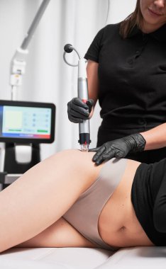 Kozmetik uzmanının mikronlama cihazını kullanarak kadın kalçasında radyasyon tedavisi uygularken kapatın. Güzellik salonunda cilt gerdirme izleri çıkarma prosedürü olan bir kadın..