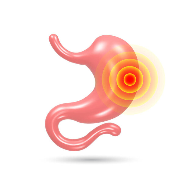 Stomach pain and heartburn. Digestive disease. Gastritis and acid reflux. 3D vector illustration.