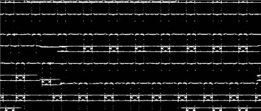 Vektör grunge dokusu. Siyah beyaz arka plan. Soyut monokrom resim koyu tonlarda solmuş bir efekt içerir