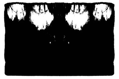 Çizik ve çizgilerle siyah beyaz dokuda sıkıntılı bir arkaplan