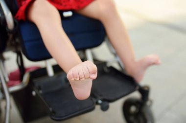 Tekerlekli sandalyede oturan engelli kız. Bacağındaki spazm kaslarının fotoğrafını çek. Çocuk serebral felci. Engelli. Katılım. Engelli çocuklu bir aile. Engelli çocuklu aile.