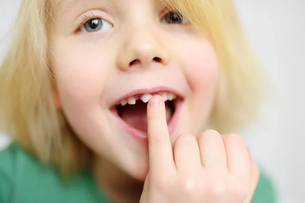 男孩在乳牙变成磨牙之前 在张开的嘴上摇晃着摇动着乳牙的肖像 成长为孩子的阶段 婴儿保健和牙齿卫生 — 图库照片