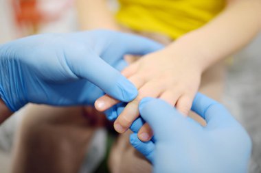 Küçük çocuk kolundan yaralanmış bir doktor travmatologla randevuda. Çocuk çimdikledi ya da parmağını kırdı. Bir ortopedi cerrahı küçük bir hastanın eklemlerini inceliyor. Çocuklarda yaralanma