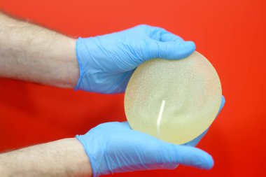 Mammolog kırmızı arka planda silikon implantı tutuyor. Göğüs şekli düzeltme - kaldırma, küçültme, yeniden yapılandırma, büyütme, implantlar. Göğüs kanseri. Estetik estetik ameliyat