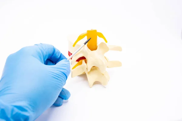 A doctor in blue gloves and a gown points to the cervical vertebra with a pointer, talking about the spinal cord. For use in presentations, advertising, and more.