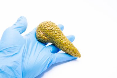 Bir gastroenteroloğun, endokrinoloğun ya da diğer bir doktorun eldivenli eli pankreasın anatomik modelini tutar, bu salgı bezinin diyabet ya da pankreas iltihabı ya da diğer hastalıklara odaklanır.
