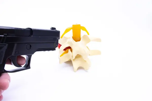 stock image Gunshot wound to the spine with spinal cord concept photo. A hand with a gun aims at the anatomical figure of the spine with cord and spinal roots on a white background. Photo for surgery, neurosurgery, military surgery and forensic medicine.