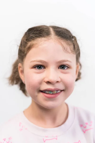 stock image Little girl with rainbow braces smiling at the camera.