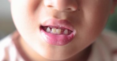 Ön dişi eksik, çocuk diş bakımı eksik, süt dişleri dökülüyor, çocuk sağlığı, diş boşluğu gösteren mutlu çocuk, ilk dişini kaybetmiş, büyüyen konsept. 4K video.